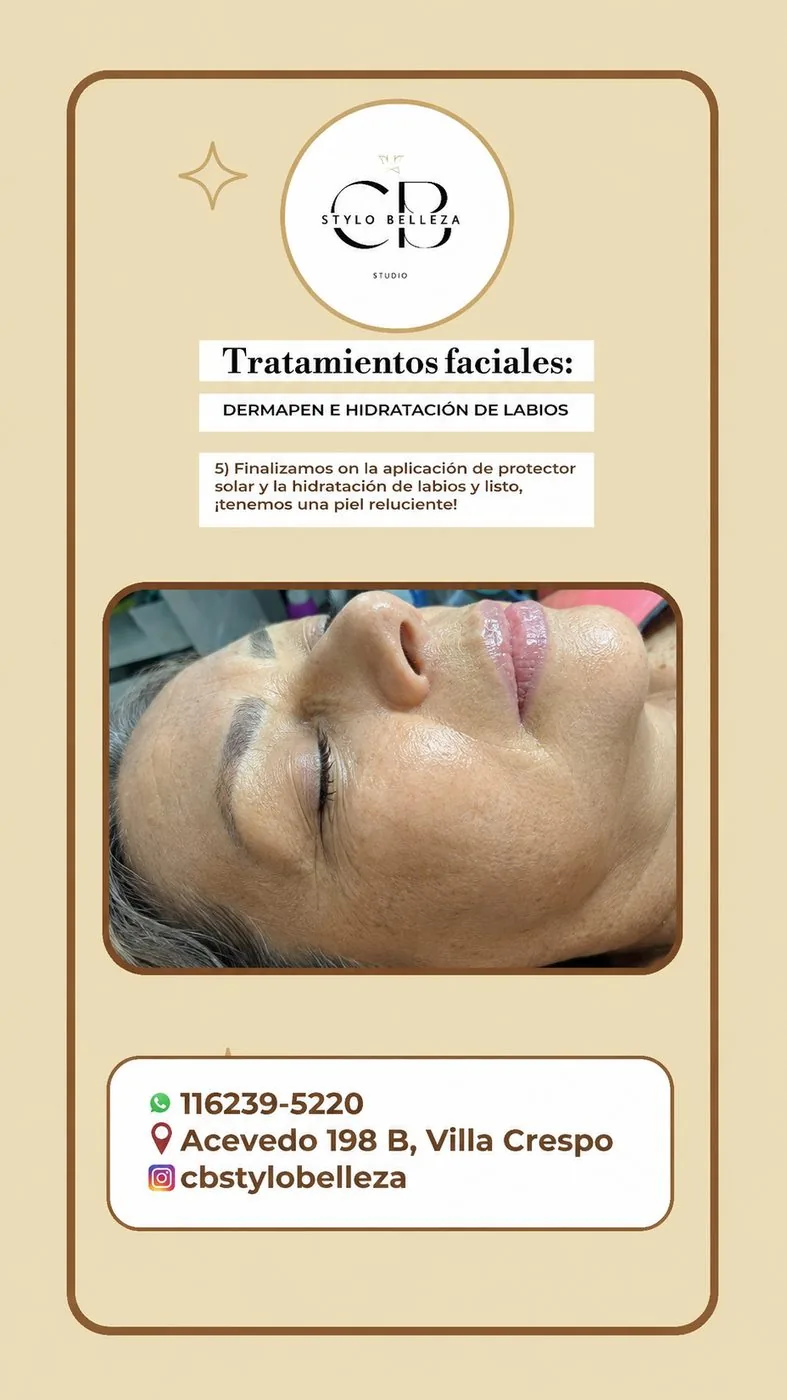 Dermapen e hidratación de labios en CB Stylo Belleza, Villa Crespo
